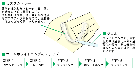 z[zCgjO̎菇